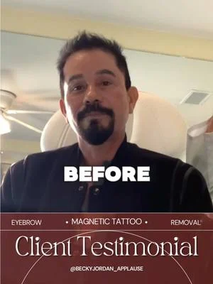 ⭐️Client Testimonial⭐️ using 🧲𝗠𝗮𝗴𝗻𝗲𝘁𝗶𝗰 𝗧𝗮𝘁𝘁𝗼𝗼 𝗥𝗲𝗺𝗼𝘃𝗮𝗹™️ for botched...