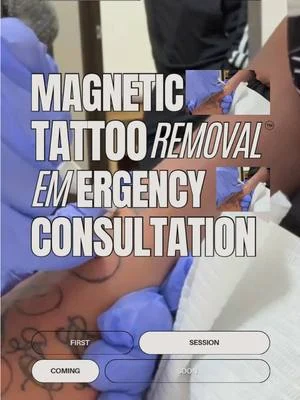 Parents brought their son into my office for an  emergency🚨 Magnetic Tattoo Removal...