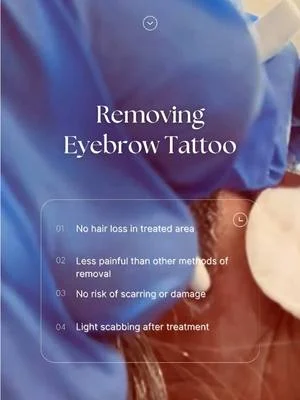 ✅Fourth Session✅ 🧲𝗠𝗮𝗴𝗻𝗲𝘁𝗶𝗰 𝗧𝗮𝘁𝘁𝗼𝗼 𝗥𝗲𝗺𝗼𝘃𝗮𝗹™️ for removing eyebrow tattoo.