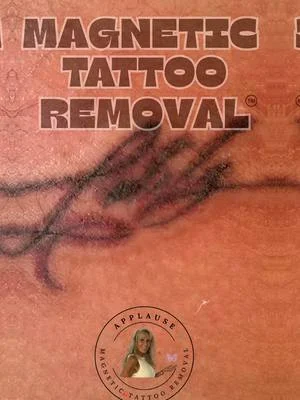 🧲𝗠𝗮𝗴𝗻𝗲𝘁𝗶𝗰 𝗧𝗮𝘁𝘁𝗼𝗼 𝗥𝗲𝗺𝗼𝘃𝗮𝗹™️ on a home made tattoo my client recieved less...